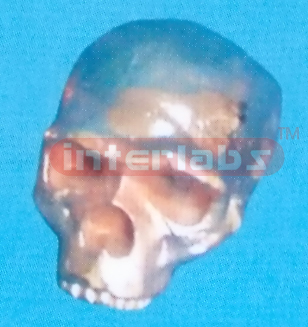 COPPERIZED STEINEIN MAN SKULL